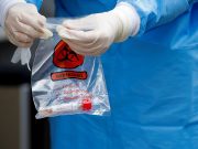 Estado confirma 17.937 casos e 256 mortes por Covid-19