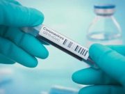 Com mais uma morte em Tubarão, Estado confirma 13.165 casos e 191 óbitos por covid-19