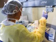 Coronavírus em SC: Lacen recebe cinco mil kits de extração para testes