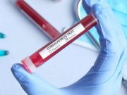 Estado confirma 35.343 casos e 420 mortes por Covid-19