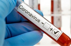 SC confirma 98.634 casos, 85.913 recuperados e 1.357 mortes por covid-19