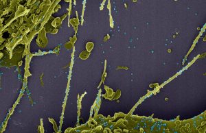 Pesquisadores identificam possível nova linhagem do coronavírus