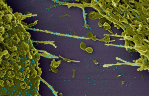 Nova variante do coronavírus pode ser até 40% mais letal