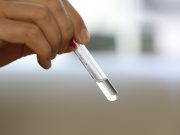 6º foco do Aedes Aegypti é confirmado em Imbituba neste ano