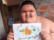 Criança de 10 anos com 200 Kg luta para ficar viva em SC