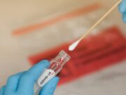 Mais de 18 mil testes para Covid-19 já foram registrados no município de Capivari de Baixo