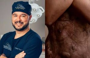 Médico que deformou paciente com cirurgias plásticas é condenado